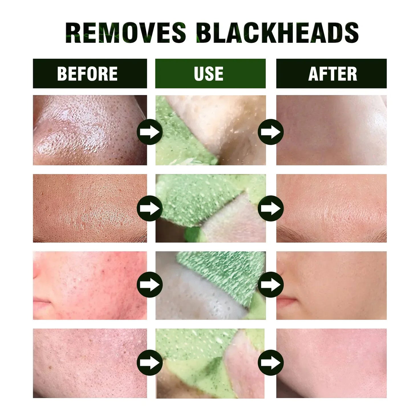 Blackhead Remover Face Mask Cream