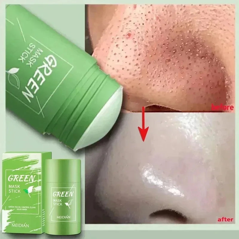 Blackhead Remover Face Mask Cream